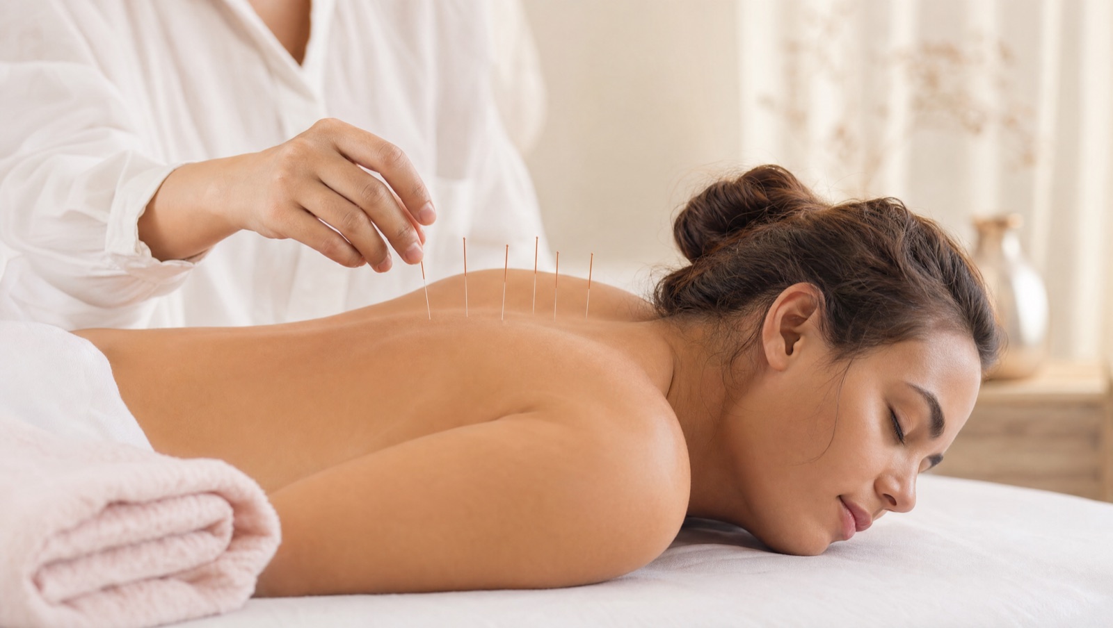 Practitioner placing fine acupuncture needles along a patient's upper back during a pain-relief treatment